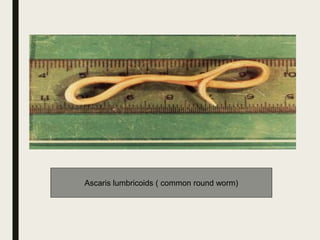 Ascaris lumbricoids ( common round worm)
 