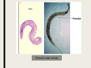 Pinworm male ,female
 