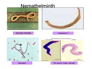 Nemathelminth
 