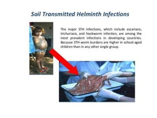Anthelmintics | PPTX