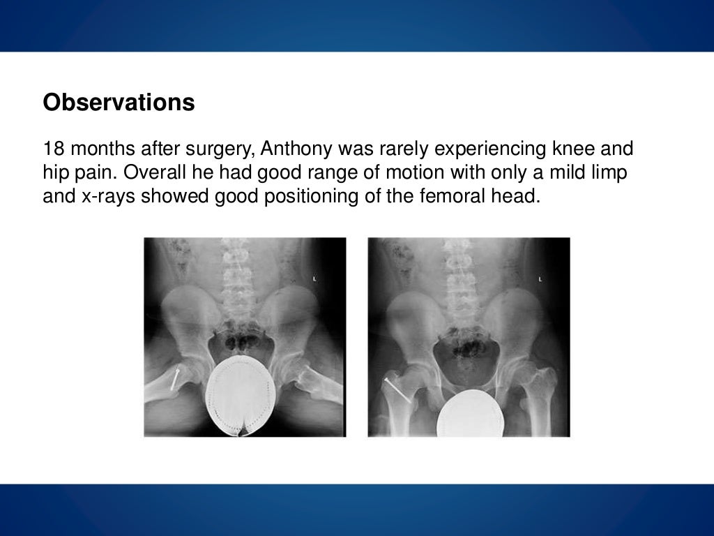 Coxa breva radiology picture