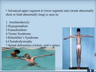 • Advanced upper segment to lower segment ratio (trunk abnormally 
short or limb abnormally long) is seen in: 
1. Arachnodactyly 
2.Hypogonadism 
3.Eunuchoidism 
4.Turner Syndrome 
5.Klinefelter’s Syndrome 
6.Chondrodystrophy 
7.Spinal deformities (rickets, pott’s spine) 
44 
 