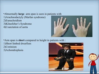 •Abnormally large arm span is seen in patients with 
1)Arachnodactyly (Marfan syndrome) 
2)Eunuchoidism 
3)Klinefelter’s Syndrome 
4)Coarctation of aorta 
•Arm span is short compared to height in patients with : 
1)Short limbed dwarfism 
2)Cretinism 
3)Achondroplasia 
47 
 