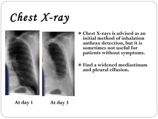 Chest X-ray
                       Chest X-rays is advised as an
                        initial method of inhalation
                        anthrax detection, but it is
                        sometimes not useful for
                        patients without symptoms.

                       Find a widened mediastinum
                        and pleural effusion.




At day 1   At day 3
 