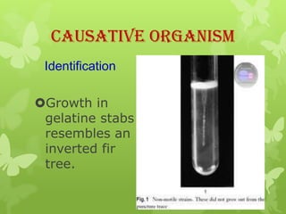 Causative Organism
 Identification

Growth in
 gelatine stabs
 resembles an
 inverted fir
 tree.
 