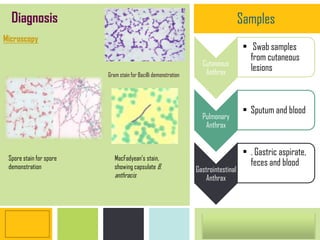 P: 555.123.4568 F: 555.123.4567
123 West Main Street, New York,
NY 10001
www.rightcare.com|
Cutaneous
Anthrax
• Swab samples
from cutaneous
lesions
Pulmonary
Anthrax
• Sputum and blood
Gastrointestinal
Anthrax
• . Gastric aspirate,
feces and blood
Microscopy
Diagnosis Samples
Gram stain for Bacilli demonstration
MacFadyean's stain,
showing capsulate B.
anthracis
Spore stain for spore
demonstration
 