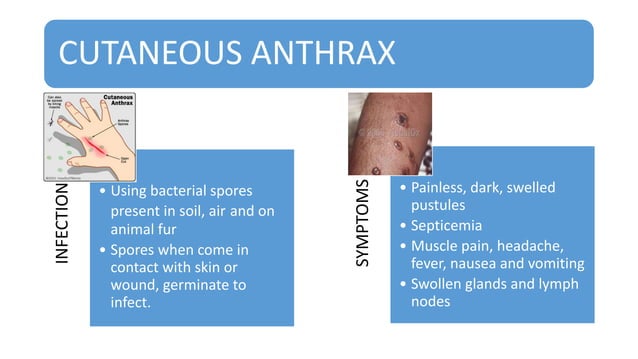Anthrax | PPT