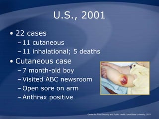 U.S., 2001
• 22 cases
– 11 cutaneous
– 11 inhalational; 5 deaths
• Cutaneous case
– 7 month-old boy
– Visited ABC newsroom
– Open sore on arm
– Anthrax positive
Center for Food Security and Public Health, Iowa State University, 2011
 