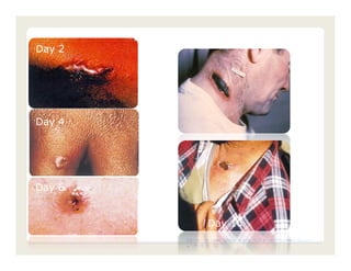 Day 6
Day 2




Day 4




Day 6
Day 6


                 Day 10
        Center for Food Security and Public Health, Iowa State
        University, 2011
 