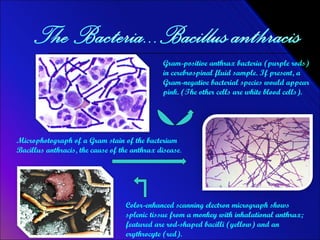 Gram-positive anthrax bacteria (purple rods) in cerebrospinal fluid sample. If present, a Gram-negative bacterial species would appear pink. (The other cells are white blood cells). Microphotograph of a Gram stain of the bacterium Bacillus anthracis, the cause of the anthrax disease . Color-enhanced scanning electron micrograph shows splenic tissue from a monkey with inhalational anthrax; featured are rod-shaped bacilli (yellow) and an erythrocyte (red). 