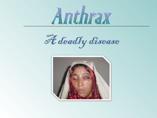 Anthrax A deadly disease 