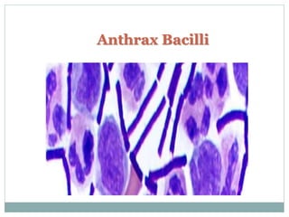 Anthrax Bacilli
 