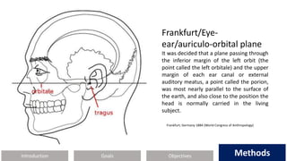 Introduction Methods
Objectives
Goals Methods
Frankfurt/Eye-
ear/auriculo-orbital plane
It was decided that a plane passing through
the inferior margin of the left orbit (the
point called the left orbitale) and the upper
margin of each ear canal or external
auditory meatus, a point called the porion,
was most nearly parallel to the surface of
the earth, and also close to the position the
head is normally carried in the living
subject.
Frankfurt, Germany 1884 (World Congress of Anthropology)
 