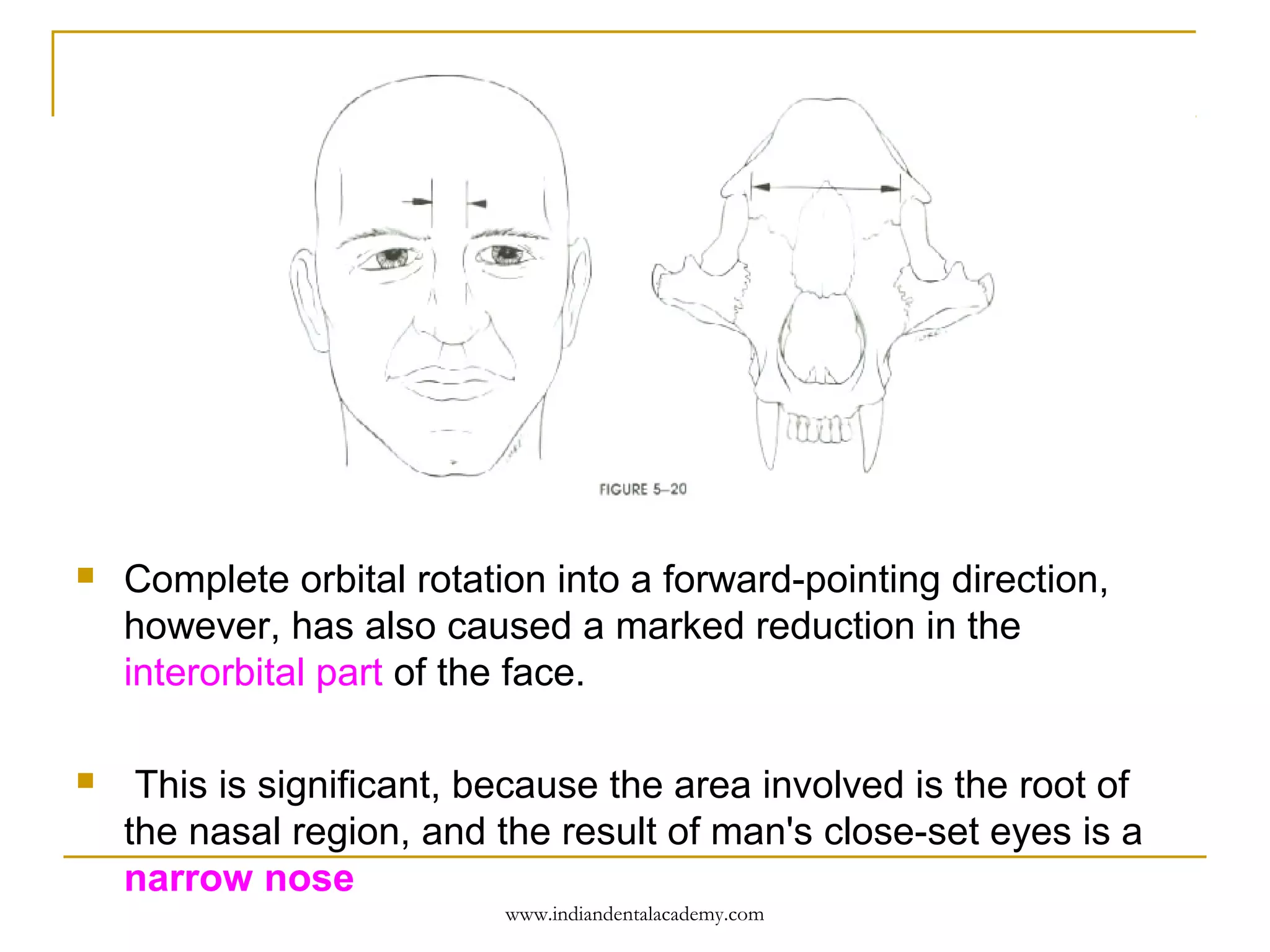

Complete orbital rotation into a forward-pointing direction,
however, has also caused a marked reduction in the
interorbital part of the face.



This is significant, because the area involved is the root of
the nasal region, and the result of man's close-set eyes is a
narrow nose
www.indiandentalacademy.com

 