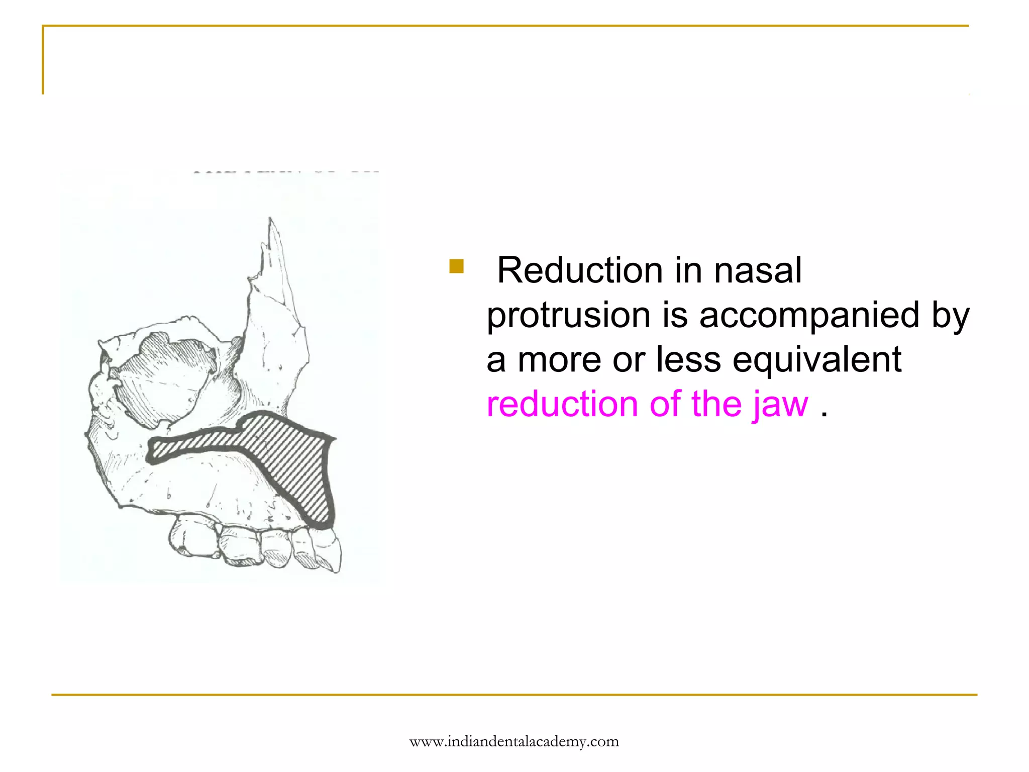 

Reduction in nasal
protrusion is accompanied by
a more or less equivalent
reduction of the jaw .

www.indiandentalacademy.com

 