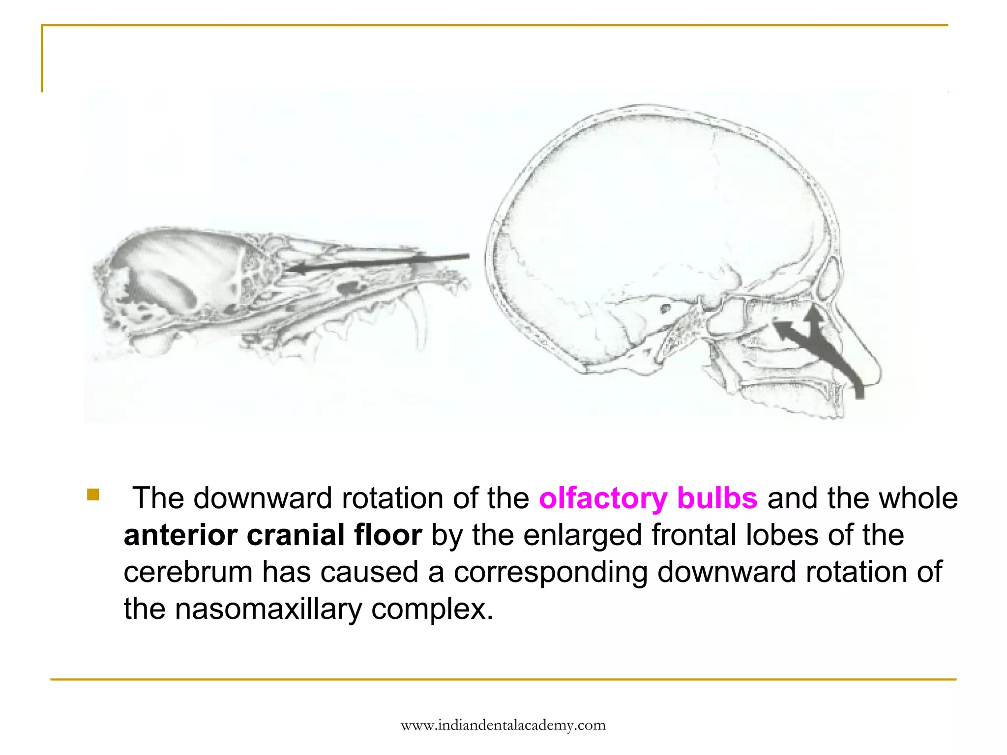 

The downward rotation of the olfactory bulbs and the whole
anterior cranial floor by the enlarged frontal lobes of the
cerebrum has caused a corresponding downward rotation of
the nasomaxillary complex.

www.indiandentalacademy.com

 