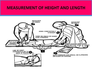 Anthropometric assessment | PPTX