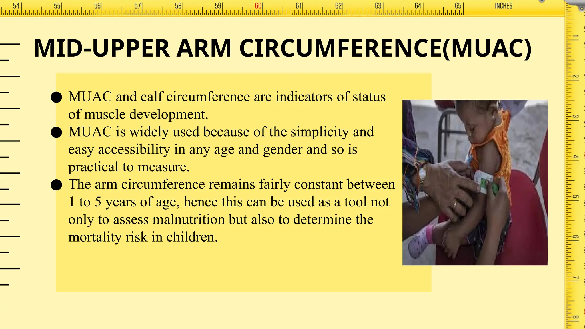ANTHROPOMETRIC INDICATORS AND ASSESSMENT OF THE NUTRITIONAL STATUS.pptx ...
