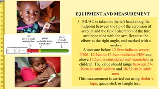 Muac How To Guide ANTHROPOMETRIC INDICATORS AND ASSESSMENT OF THE NUTRITIONAL STATUS.pptx