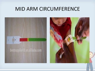 MID ARM CIRCUMFERENCE
28
 