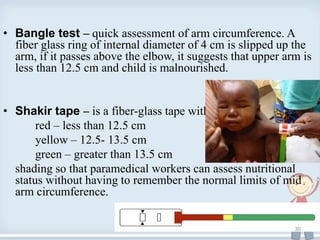 • Bangle test – quick assessment of arm circumference. A
fiber glass ring of internal diameter of 4 cm is slipped up the
arm, if it passes above the elbow, it suggests that upper arm is
less than 12.5 cm and child is malnourished.
• Shakir tape – is a fiber-glass tape with
red – less than 12.5 cm
yellow – 12.5- 13.5 cm
green – greater than 13.5 cm
shading so that paramedical workers can assess nutritional
status without having to remember the normal limits of mid
arm circumference.
30
 