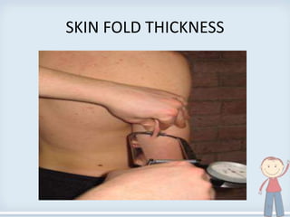 SKIN FOLD THICKNESS
31
 