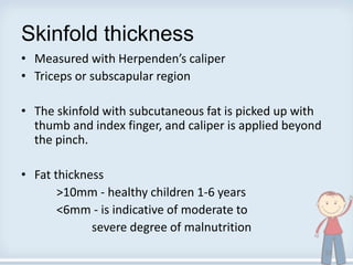 Skinfold thickness
• Measured with Herpenden’s caliper
• Triceps or subscapular region
• The skinfold with subcutaneous fat is picked up with
thumb and index finger, and caliper is applied beyond
the pinch.
• Fat thickness
>10mm - healthy children 1-6 years
<6mm - is indicative of moderate to
severe degree of malnutrition
32
 