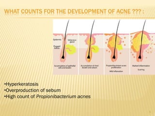 Anti-acne Preparations | PDF
