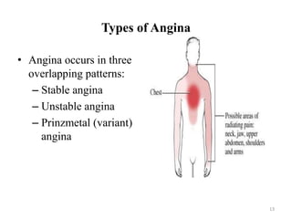 Anti-angina_F.K.ppt_for_midwife[1].pptx
