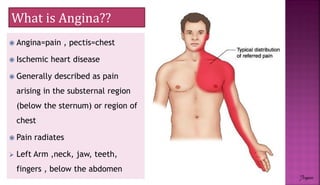 Anti Anginal drugs | PDF