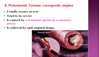 Anti Anginal drugs | PDF