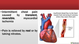 ▪Intermittent chest pain
caused by transient,
reversible, myocardial
ischemia
▪Pain is relieved by rest or by
taking nitrates.
 