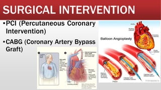 SURGICAL INTERVENTION
▪PCI (Percutaneous Coronary
Intervention)
▪CABG (Coronary Artery Bypass
Graft)
 