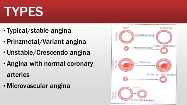 l action of mechanism action, anginal effects uses, adverse Anti mechanism drugs, of l action of mechanism action, anginal effects uses, adverse Anti mechanism drugs, of