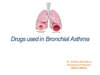 Drugs usedin Bronchial Asthma
Dr. Shikha Sachdeva
Assistant Professor
MMCP,MMDU
 