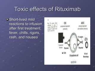 Toxic effects of Rituximab
Toxic effects of Rituximab
Short-lived mild
Short-lived mild
reactions to infusion
reactions to infusion
after first treatment:
after first treatment:
fever, chills, rigors,
fever, chills, rigors,
rash, and nausea
rash, and nausea
 