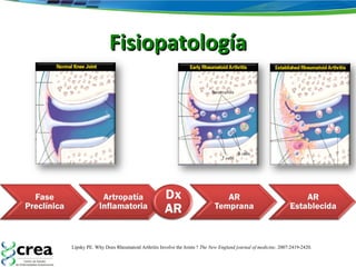 FisiopatologíaFisiopatología
Lipsky PE. Why Does Rheumatoid Arthritis Involve the Joints ?  The New England journal of medicine. 2007:2419-2420.
 