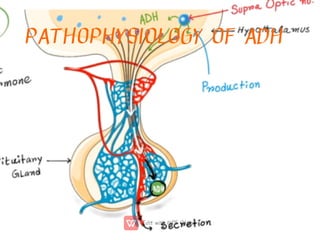 PATHOPHYSIOLOGY OF ADH
 