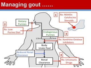 Managing gout ……
 