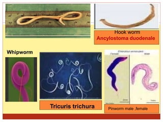 9
Ascaris lumbricoids (Comm R.W.) Hook worm
Ancylostoma duodenale
Tricuris trichura
Whipworm
Pinworm male ,female
 