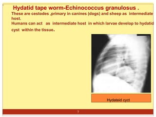 -
Hydatid tape worm-Echinococcus granulosus .
These are cestodes ,primary in canines (dogs) and sheep as intermediate
host.
Humans can act as intermediate host in which larvae develop to hydatid
cyst within the tissue.
Hydateid cyct
7
 
