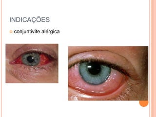 INDICAÇÕES
   conjuntivite alérgica
 