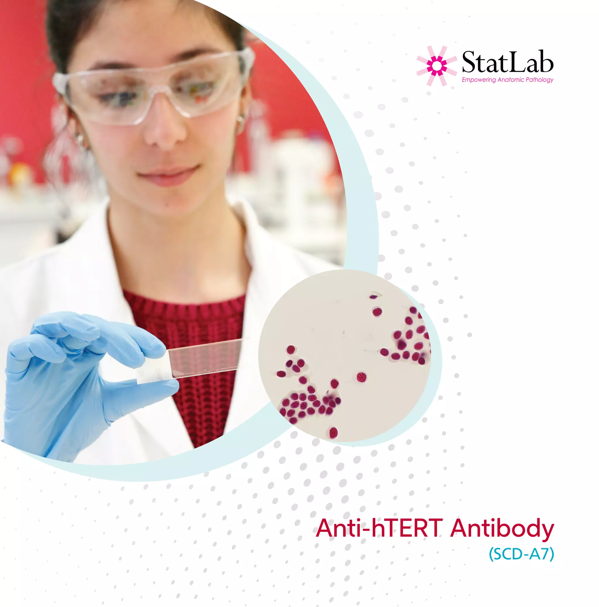 Anti hTERTcatalog StatLab PDF