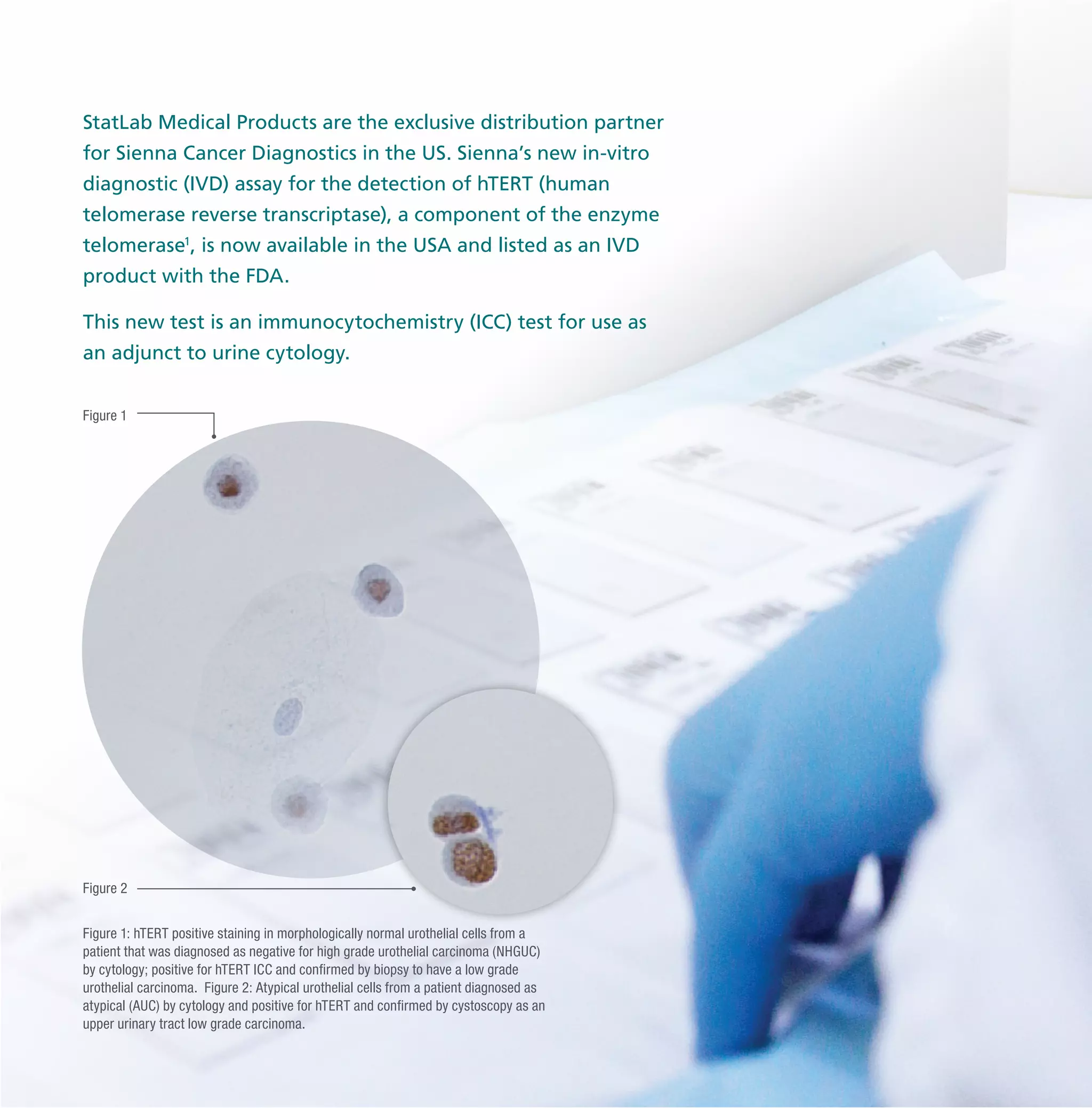 Anti hTERTcatalog StatLab PDF