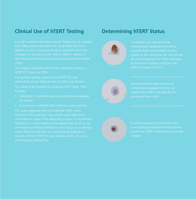 Anti hTERTcatalog StatLab PDF