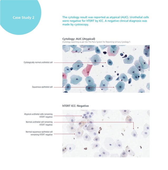 Anti hTERTcatalog StatLab PDF