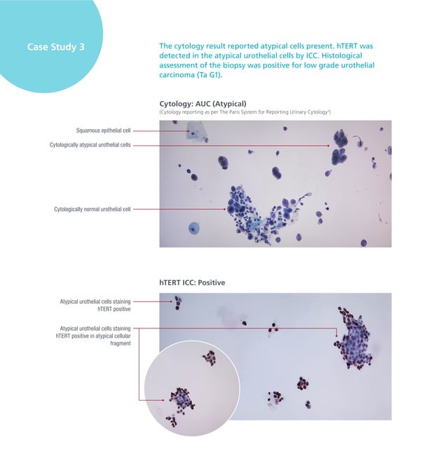 Anti hTERTcatalog StatLab PDF