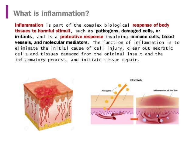 Inflammation and cytokine