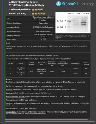 Result
“In slice culture lysates, there were target bands detected by STJ91464 Anti-p47-phox antibody.“- R. Ferreira , IBMC
Portugal.
Gel electrophoresis information：10% polyacrylamide gel, constant voltage 100 V, 60 min.
Transfer information：0.45 nm PVDF membrane, 1 piece of gel (semi-dry transfer), constant voltage 25 V 27 min.
Lane No. Antigen
Loading
amount
Primary anti-
body
Primary anti-
body dilution
ratio
Secondary
antibody dilution
ratio
Target band KD
Visualiza-
tion time
1
Slice cultures
lysate
30ug
STJ94885 Anti-
p47-phox Anti-
body
1:1000
~44KD 10S
1:10000
2
Slice cultures
lysate
~44KD 10S
Cell Line:
Murine brain tissue (obtained
from organotypic slice cul-
tures)
Method of validation: Western Blot
Primary Antibody: STJ94885 Anti-p47-phox Anti-
Secondary Antibody HRP goat anti-rabbit
Reference Antibody
GAPDH (provided by Milli-
pore)
Dilution ratio: 1:1000
Antibody Customer Review:
STJ94885 Anti-p47-phox Antibody
Antibody Specificity:
Antibody Rating:
Protocol
Treatment of materials: Organotypic slice cultures were subjected to hypoxia for 1 hour, followed by treatments
E.g. Gel electrophoresis: 10% polyacrylamide gel, constant voltage 100 V, 60 min.
Transfer: 0.45 nm PVDF membrane, 1 piece of gel (semi-dry transfer), constant voltage 25 V 27 min.
Blocking: 1X TBST with 5% bovine serum albumin (BSA) for 1 hr.
Primary antibody probing: primary antibody was added to the solution of 1X TBST with 5% BSA, 4˚C for overnight.
Membrane wash: 1X TBST wash for 3 times.
Secondary antibody probing: secondary antibody was added to the solution of 1X TBST with 5% BSA with 1:10000 dilu-
tion for 1 hr.
Membrane wash: 1X TBST wash for 3 times.
Visualization: ECL visualization for 5 min (the visualization time was determined by actual result. It was ensured that
the visualization time was identical for the same antigen).
Figure: Lane1: without hypoxia; Lane 2: subjected to
hypoxia
 