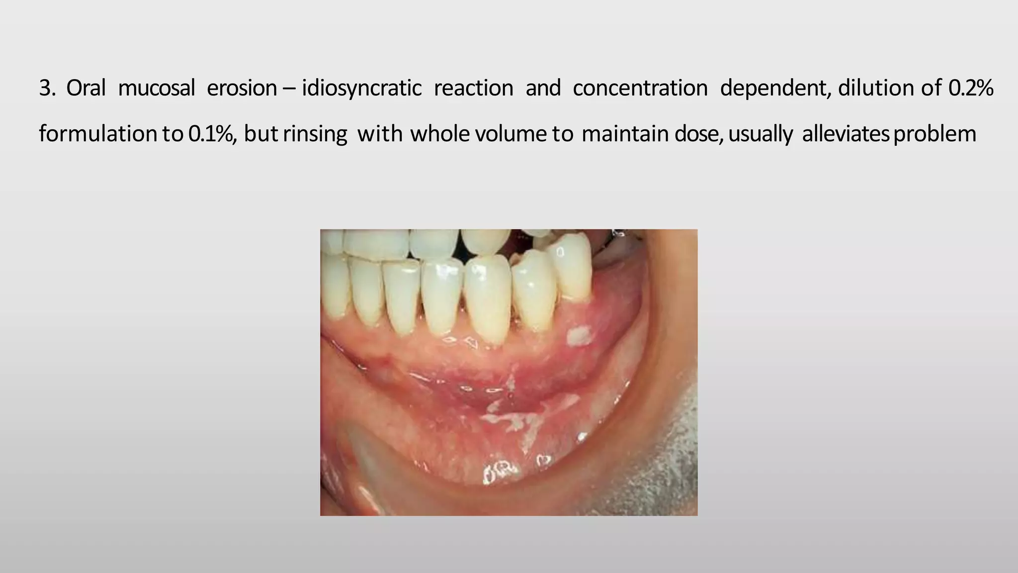 Anti plaque agents, Dr Sai Lakshmi | PPT